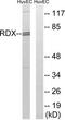 Radixin antibody, TA326113, Origene, Western Blot image 