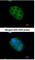 Ubiquitin carboxyl-terminal hydrolase CYLD antibody, NB100-78600, Novus Biologicals, Immunofluorescence image 