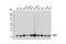 Superoxide Dismutase 2 antibody, 13141S, Cell Signaling Technology, Western Blot image 