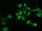N-Acetylneuraminic Acid Phosphatase antibody, NBP2-01935, Novus Biologicals, Immunocytochemistry image 