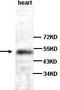Calponin 3 antibody, TA310146, Origene, Western Blot image 