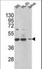 3-keto-steroid reductase antibody, LS-C165038, Lifespan Biosciences, Western Blot image 