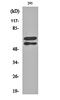 LYN Proto-Oncogene, Src Family Tyrosine Kinase antibody, orb159709, Biorbyt, Western Blot image 