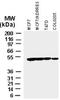 X-Linked Inhibitor Of Apoptosis antibody, NB100-56183, Novus Biologicals, Western Blot image 