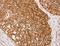 Adenylate Kinase 2 antibody, LS-C401373, Lifespan Biosciences, Immunohistochemistry paraffin image 