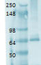 Sodium-iodide symporter antibody, TA326382, Origene, Western Blot image 
