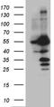 Serine/threonine-protein phosphatase 2B catalytic subunit beta isoform antibody, TA809772, Origene, Western Blot image 