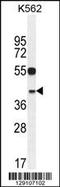 YOD1 Deubiquitinase antibody, TA324395, Origene, Western Blot image 