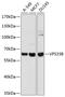 VPS33B Late Endosome And Lysosome Associated antibody, 23-726, ProSci, Western Blot image 