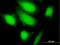 Potassium Channel Tetramerization Domain Containing 17 antibody, H00079734-B01P, Novus Biologicals, Immunocytochemistry image 