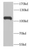 2-5A-dependent ribonuclease antibody, FNab07331, FineTest, Western Blot image 