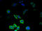 Phosphatidylinositol N-acetylglucosaminyltransferase subunit C antibody, A60262-100, Epigentek, Immunofluorescence image 