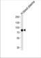 Leucine Rich Repeat Containing 45 antibody, TA324400, Origene, Western Blot image 