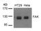 Protein Tyrosine Kinase 2 antibody, 79-433, ProSci, Western Blot image 