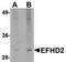 EF-Hand Domain Family Member D2 antibody, TA306945, Origene, Western Blot image 
