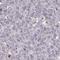 Telomerase RNA Component Interacting RNase antibody, HPA059965, Atlas Antibodies, Immunohistochemistry paraffin image 