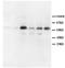 Matrix Metallopeptidase 2 antibody, PA1122-2, Boster Biological Technology, Western Blot image 