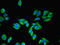 Uroplakin III antibody, LS-C676684, Lifespan Biosciences, Immunofluorescence image 