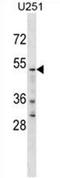 YTH N6-Methyladenosine RNA Binding Protein 2 antibody, AP54604PU-N, Origene, Western Blot image 