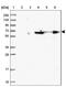 Zinc Finger Protein 577 antibody, NBP2-31013, Novus Biologicals, Western Blot image 