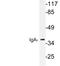 Human IgA antibody, LS-C177586, Lifespan Biosciences, Western Blot image 