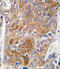 Aldehyde Dehydrogenase 1 Family Member L1 antibody, abx033714, Abbexa, Immunohistochemistry paraffin image 