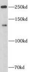 Apolipoprotein B antibody, FNab00491, FineTest, Western Blot image 