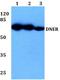 Delta/Notch Like EGF Repeat Containing antibody, A06011, Boster Biological Technology, Western Blot image 