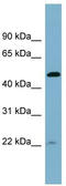 HAUS augmin-like complex subunit 7 antibody, TA344997, Origene, Western Blot image 
