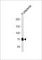NIMA Related Kinase 11 antibody, LS-C101162, Lifespan Biosciences, Western Blot image 