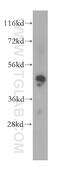 MAK16 Homolog antibody, 17505-1-AP, Proteintech Group, Western Blot image 