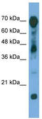 Rap1 GTPase-activating protein 1 antibody, TA342188, Origene, Western Blot image 