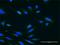 Ubiquitin carboxyl-terminal hydrolase 47 antibody, H00055031-M02, Novus Biologicals, Immunocytochemistry image 
