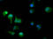 3'-Phosphoadenosine 5'-Phosphosulfate Synthase 2 antibody, LS-C681002, Lifespan Biosciences, Immunofluorescence image 