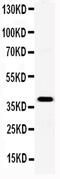Paired Like Homeodomain 2 antibody, PA5-78789, Invitrogen Antibodies, Western Blot image 