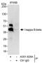 NFKB Inhibitor Beta antibody, A301-828A, Bethyl Labs, Immunoprecipitation image 