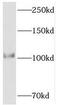 Protein Phosphatase 1 Regulatory Subunit 15B antibody, FNab06705, FineTest, Western Blot image 