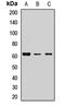 USH1 Protein Network Component Harmonin antibody, orb412271, Biorbyt, Western Blot image 
