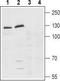 Adhesion G Protein-Coupled Receptor L1 antibody, TA328869, Origene, Western Blot image 