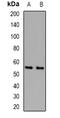 Cell death regulator Aven antibody, orb382545, Biorbyt, Western Blot image 