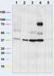 Voltage Dependent Anion Channel 1 antibody, ab14734, Abcam, Western Blot image 