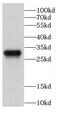 Capping Actin Protein Of Muscle Z-Line Subunit Beta antibody, FNab01259, FineTest, Western Blot image 