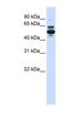 Cytochrome P450 Family 3 Subfamily A Member 43 antibody, NBP1-62393, Novus Biologicals, Western Blot image 