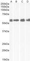 Corticotropin-releasing factor receptor 1 antibody, STJ71309, St John