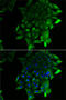 Sep (O-Phosphoserine) TRNA:Sec (Selenocysteine) TRNA Synthase antibody, 22-701, ProSci, Immunofluorescence image 