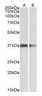 Protein arginine N-methyltransferase 2 antibody, orb12283, Biorbyt, Western Blot image 
