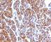 Moesin antibody, V7107IHC-7ML, NSJ Bioreagents, Immunohistochemistry paraffin image 