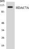 Histone Deacetylase 7 antibody, LS-B14671, Lifespan Biosciences, Western Blot image 