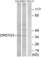 Olfactory Receptor Family 51 Subfamily G Member 1 (Gene/Pseudogene) antibody, A16524, Boster Biological Technology, Western Blot image 