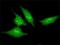 Putative SCAN domain-containing protein 2 antibody, H00054581-M02, Novus Biologicals, Immunofluorescence image 